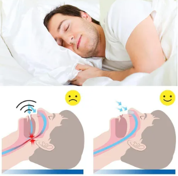 Miniatura 2 de Tiras Magneticas Nasales